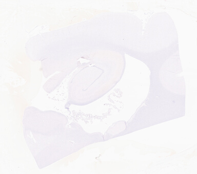 ['deident_95ef0bfa-7760-4397-8c1f-409698093ad3_69d95ed0.jpg']
