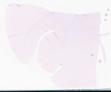 ['deident_3c0d94c2-e89b-4083-bb16-d33686d9ec59_69d95ea7.jpg']
