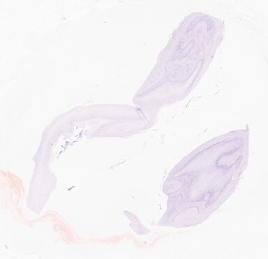 ['deident_f512c9fa-a8b2-484d-85ad-cc182a58282f_69d95efc.jpg']