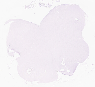 ['deident_634aa54d-5590-498e-ac1b-739c80c8a89e_69d95eb6.jpg']