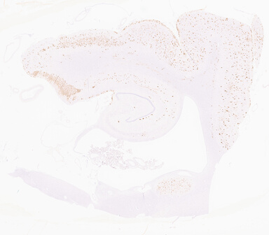 ['deident_f92be083-8025-4189-ba76-5b2cf02b56f9_69d95f03.jpg']