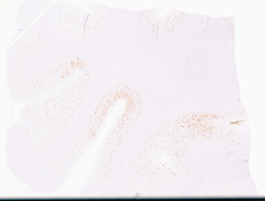 ['deident_e599bc17-96a1-44b4-8f3a-9268e22bf742_69d95ef2.jpg']