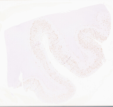 ['deident_e23ae6e4-e539-4ff8-87b1-6420c5d7a447_69d95ef1.jpg']