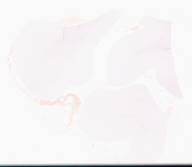 ['deident_dfe6af65-4b6a-4031-a0dd-3d2add7b5c4b_69d95eef.jpg']