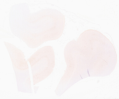 ['deident_38cdb05a-a1dc-4c80-b319-0798f9451283_69d95ea3.jpg']