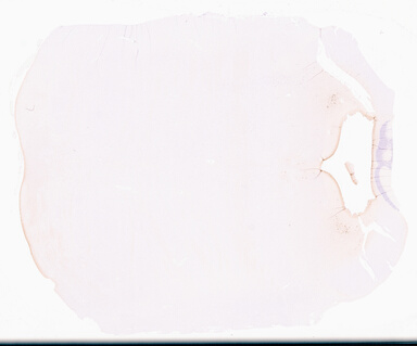 ['deident_067f593a-6205-411f-95f6-f75734162f89_69d95e96.jpg']