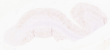 ['deident_a8d2f909-a7ae-429b-8593-53eb3145dec9_69d95ed8.jpg']