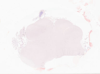 ['deident_45278746-5f05-4560-afbd-67160378981d_69b06406.jpg']