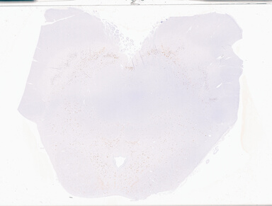 ['deident_1334e137-76ea-4b5c-88bc-e7993d8cb8a3_69b063f2.jpg']