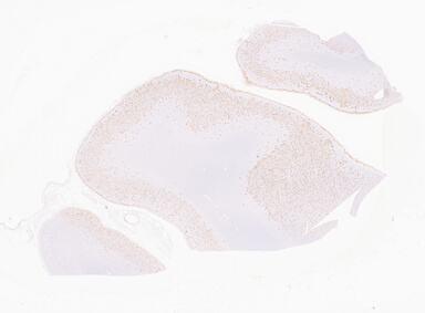 ['deident_570f66fa-ca29-4626-a314-a7b383589628_69b06411.jpg']