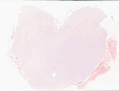 ['deident_1f4a9b99-677d-4077-9072-c10308a69b8e_69b063fa.jpg']