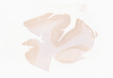 ['deident_06b09233-172e-4fd6-8dca-3706598521e5_69b063e8.jpg']