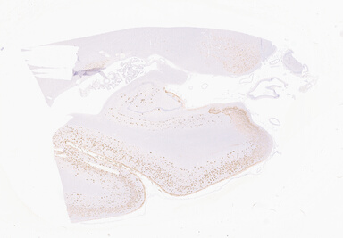 ['deident_b6f66d86-8f7d-491c-9f1a-fc10adce43a7_69b06440.jpg']