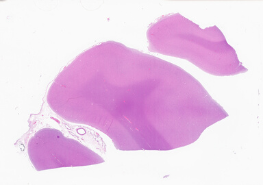 ['deident_56bde5a5-bee0-468f-beb3-fa89cb7901bb_69b0640f.jpg']