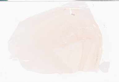 ['deident_871562f6-6534-41fb-8089-9bb6dd000076_69b06429.jpg']