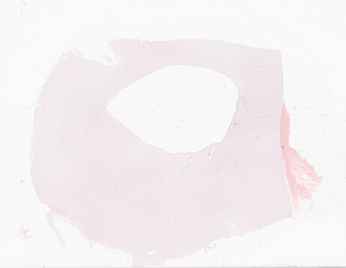 ['deident_7b2cd64c-f012-444c-a123-a48d2d4c48bb_69b06421.jpg']