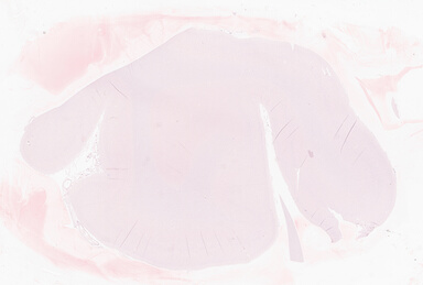 ['deident_e4564d25-d243-4550-a121-f7e9783b1a71_69b0644e.jpg']