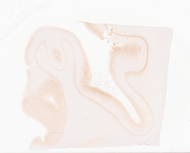 ['deident_23bd4f86-2478-4cda-83c6-ea324ab17211_69b063fc.jpg']