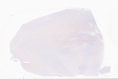 ['deident_c6487c3a-6cb4-453e-9560-eff524ee9a67_69b06442.jpg']