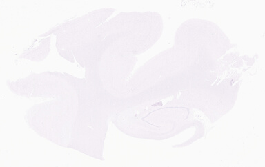 ['deident_4c76762a-4047-4d4e-b5ba-5fcf618aa8eb_69b0640a.jpg']