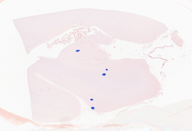 ['deident_9667ab28-3e64-493d-be41-6425f90b9ac3_69b06435.jpg']
