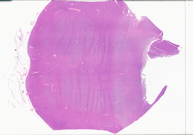 ['deident_38a5fd8f-27ad-4f6e-97a1-0a7daa194c07_69b063fe.jpg']
