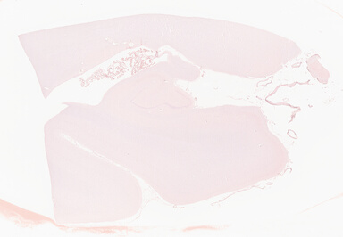 ['deident_78cd2d96-878a-487b-bb8b-ddde441f58d2_69b0641f.jpg']