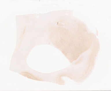 ['deident_65a26ed7-12ef-4400-a61d-42469700c75e_69b06414.jpg']