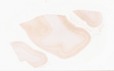 ['deident_0f91c18e-5271-4a31-b5c2-8b41ec4dbe41_69b063ef.jpg']