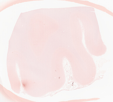 ['deident_fc467ea1-ba5e-44ab-ae4f-2ba2fe855409_69b06458.jpg']