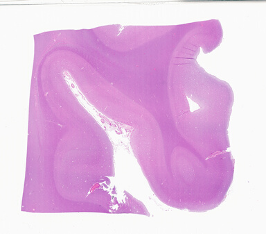 ['deident_59aca81a-bfe0-4e92-8074-57ad7a9eb81a_69b06412.jpg']
