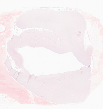 ['deident_6d7e40bc-d1cb-4d51-8b17-df1811010a60_69b0641c.jpg']