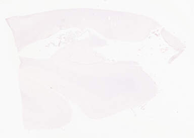 ['deident_13911bcc-0181-496b-a264-f0e61bfddd89_69b063f4.jpg']