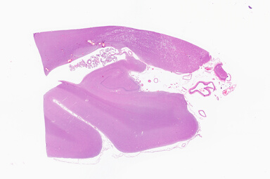 ['deident_517bcf7c-1952-43a0-87c1-bbebf2d55a4a_69b0640e.jpg']