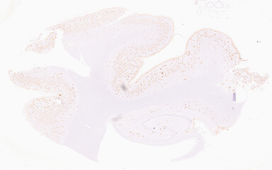 ['deident_a0b34ad6-dc56-4a32-b249-0cb7317ad77c_69b06437.jpg']
