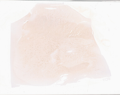 ['deident_3777310d-b06a-4337-a6cd-b61dd07f4746_69b064dc.jpg']