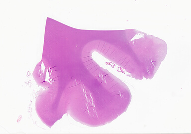 ['deident_a8d1097f-265b-4742-a9ff-29a14f854895_69b0650c.jpg']
