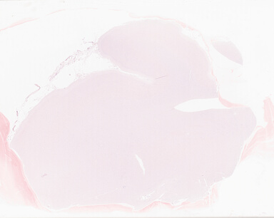 ['deident_85dab643-ce8b-4655-b1dd-1ad1d58dda9d_69b064fb.jpg']