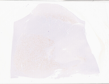 ['deident_19febc29-d052-49f9-ad2a-5aad14651825_69b064cf.jpg']