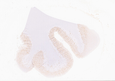 ['deident_6b48181b-6d3c-46eb-982b-5a098d0424c1_69b064ea.jpg']