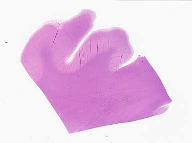 ['deident_f5e006c4-1f63-4a76-9b44-27a0b74825ee_69b06526.jpg']