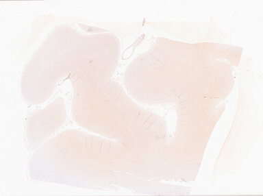 ['deident_a842c8dc-1435-4159-8a22-f36bd7021666_69b0650b.jpg']