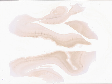 ['deident_881775d0-7a05-480c-b2a1-4c3a7ddd5c48_69b064fd.jpg']
