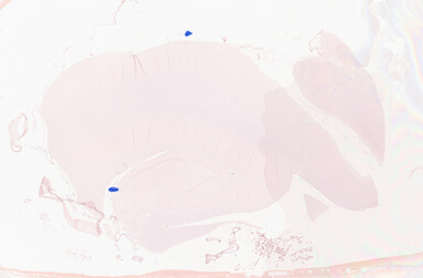 ['deident_d71538cd-4490-48cb-a8ec-dfca359f689d_69b0651b.jpg']
