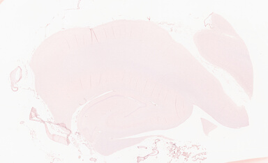 ['deident_75d1cb25-163c-4ead-8179-5e393afa727c_69b064f4.jpg']