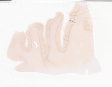 ['deident_da9c98cc-bafa-4287-a722-97807acec843_69b0651f.jpg']