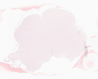 ['deident_2d0b6ee2-3c14-4eed-bd79-a77ba1c56b12_69b064d4.jpg']