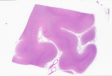 ['deident_114fc794-51bc-4f81-8140-ded409af7ce1_69b064cb.jpg']