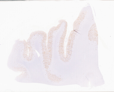 ['deident_fb79d1a8-8742-4a8a-8f01-d59a319d2edb_69b06529.jpg']