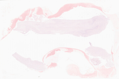 ['deident_69138217-51de-478a-8e02-ead5b526c51a_69b064e6.jpg']